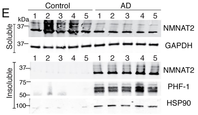 NMNAT2 protein levels were reduced in the soluble fractions of AD brains.jpg